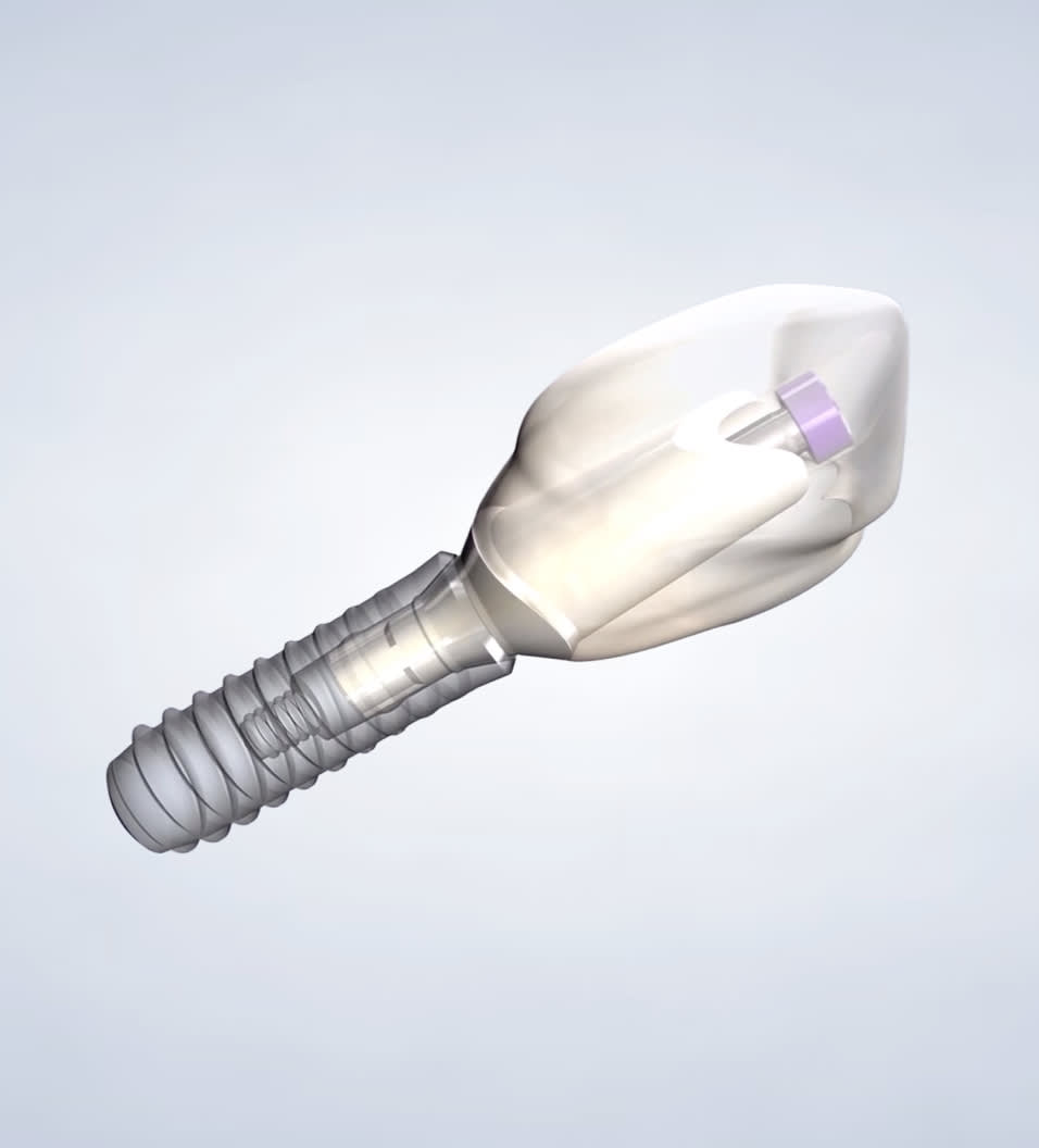 Learn about dental implants in Aliso Viejo, CA.