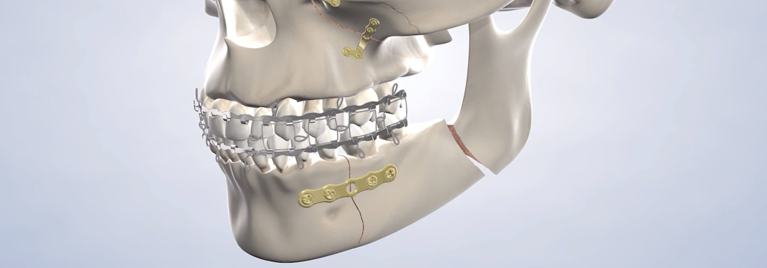 facial trauma orange county ca